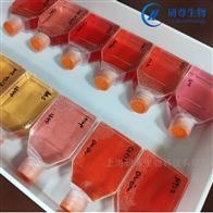 HEC-1-B人子宮內膜腺癌細胞