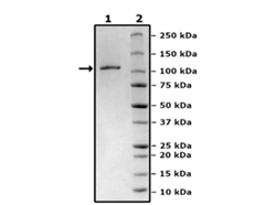 NLRP3 (NALP3), His-FLAG-Tags (Sf9-derived) Recombinant